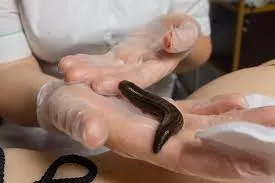 Tıbbi Sülük (Orta Boy)